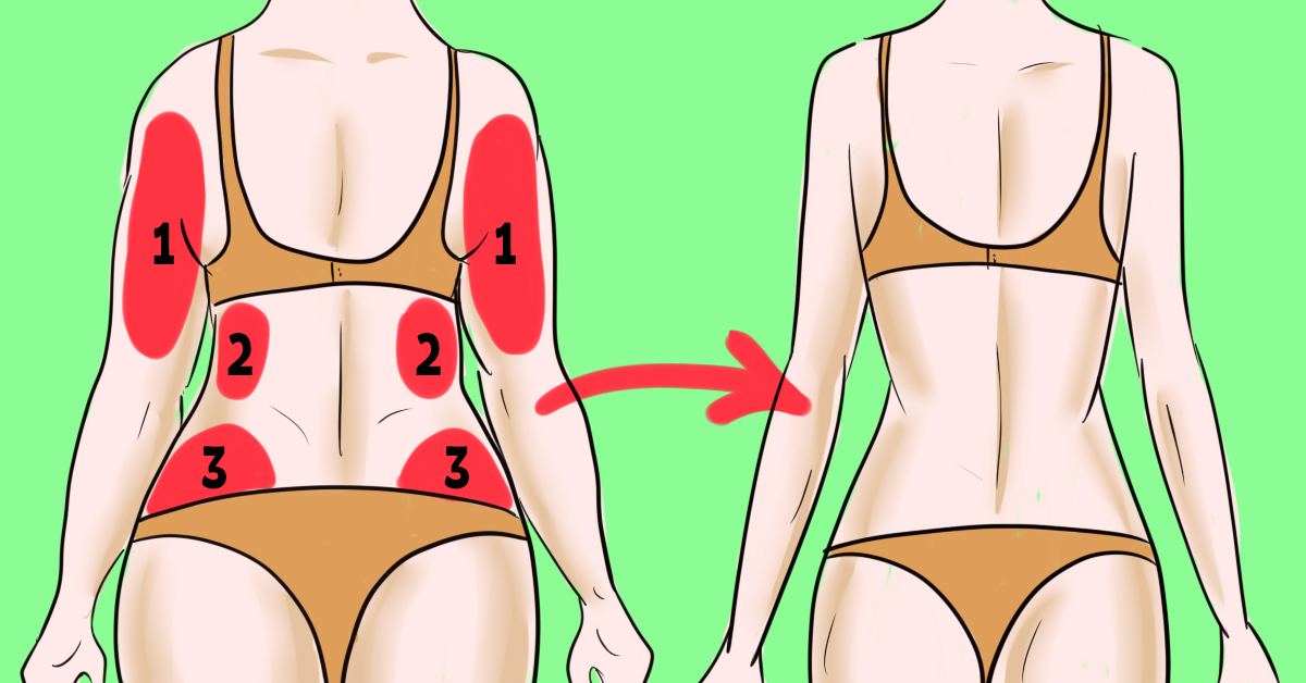 Верхняя часть толстая. Проблемные зоны тела. Проблемные зоны тела у женщин. Проблемные зоны спины.